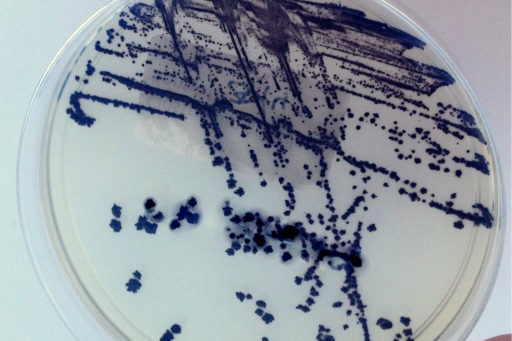 Infektionen durch Clostridioides difficile: Prävention und Rolle von Enterosorbenzien