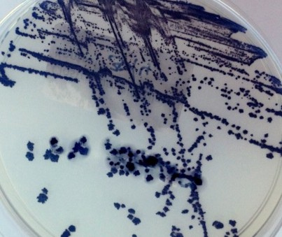 Clostridioides difficile Infections: Prevention and the role of enterosorbents