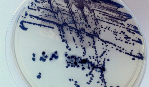 Infektionen durch Clostridioides difficile: Prävention und Rolle von Enterosorbenzien