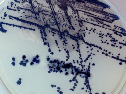Infekce způsobené Clostridioides difficile: Prevence a role enterosorbentů