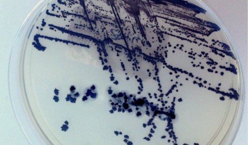 Infekce způsobené Clostridioides difficile: Prevence a role enterosorbentů